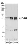 Detection of human PLCL2 by western blot.