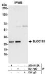 Detection of human BLOC1S3 by western blot of immunoprecipitates.