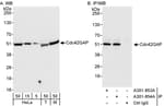 Detection of human and mouse Cdc42GAP by western blot (h&amp;m) and immunoprecipitation (h).