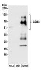Detection of human CD43 by western blot.