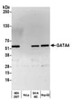 Detection of human GATA4 by western blot.