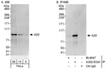 Detection of human A20 by western blot and immunoprecipitation.