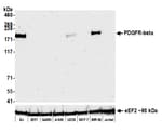 Detection of human PDGFR beta by western blot.