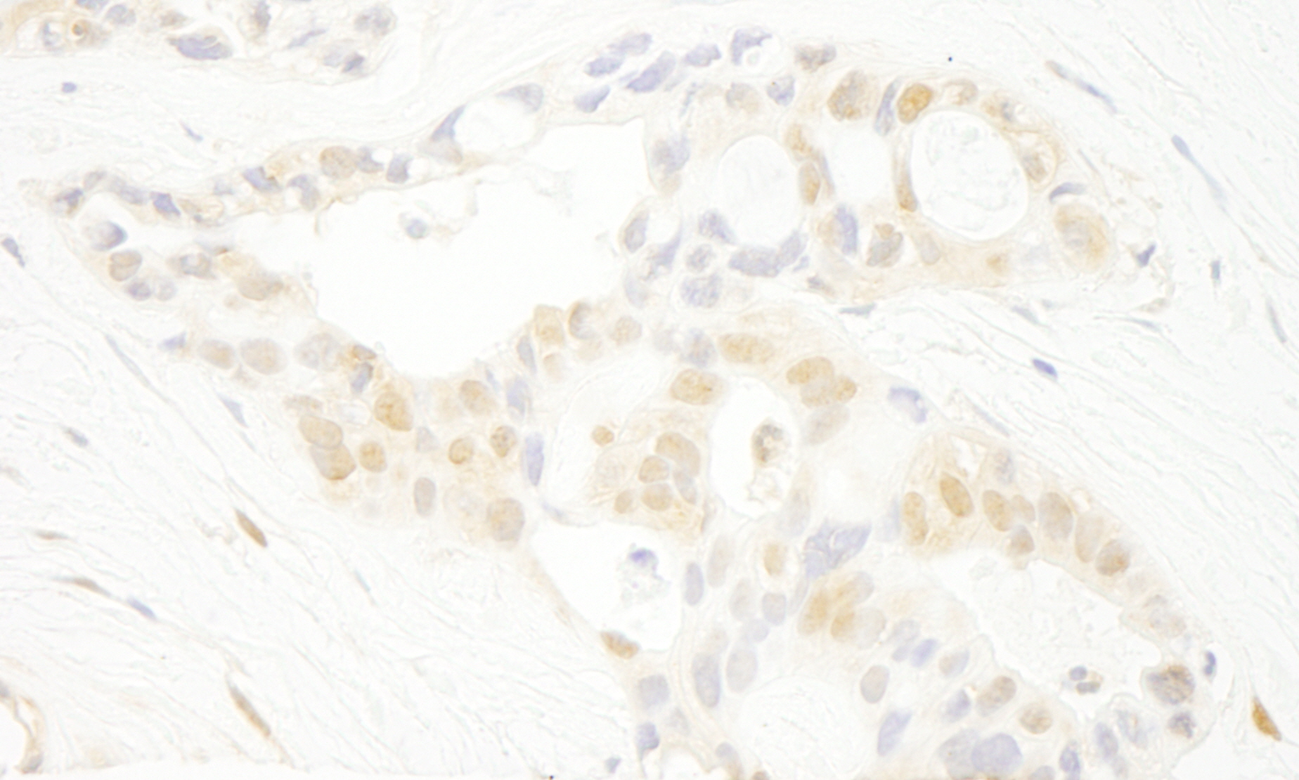 Rabbit anti-PRPF4B IHC Antibody