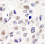 Detection of human INT7 by immunohistochemistry.