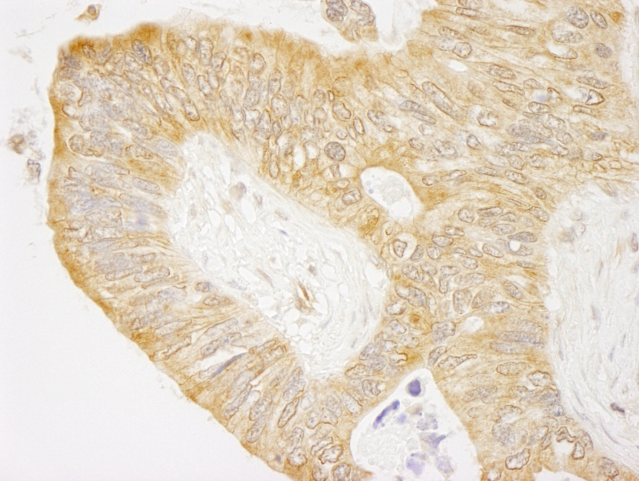 Rabbit anti-cAbl IHC Antibody