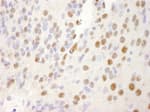 Detection of mouse NRBF2 by immunohistochemistry.