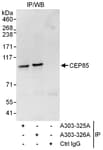 Detection of human CEP85 by western blot of immunoprecipitates.
