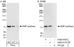 Detection of human GMP synthase by western blot and immunoprecipitation.