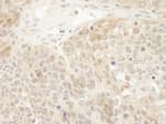 Detection of mouse DJ-1 by immunohistochemistry.