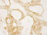 Detection of human Diaphanous1 by immunohistochemistry.