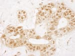 Detection of human TIGAR by immunohistochemistry.