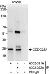 Detection of human CCDC28A by western blot of immunoprecipitates.