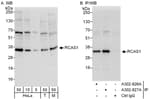 Detection of human and mouse RCAS1 by western blot (h&amp;m) and immunoprecipitation (h).
