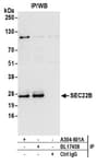 Detection of human SEC22B by western blot of immunoprecipitates.