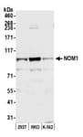 Detection of human NOM1 by western blot.