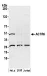 Detection of human ACTR6 by western blot.