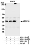 Detection of human MERIT40 by western blot of immunoprecipitates.