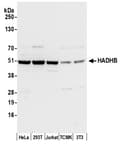 Detection of human and mouse HADHB by western blot.