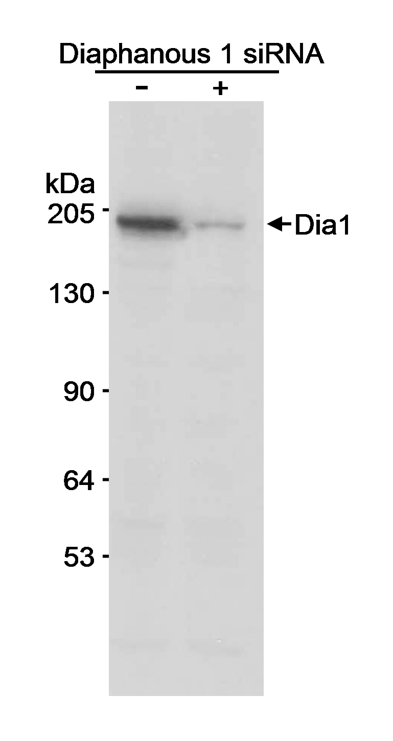Detection of human Diaphanous 1 by western blot.