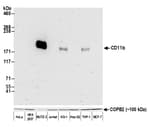 Detection of human CD11b by western blot.