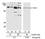 Detection of human and mouse TSC1 by western blot.