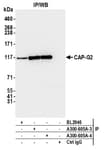 Detection of human CAP-G2 by western blot of immunoprecipitates.