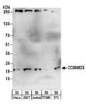 Detection of human and mouse COMMD3 by western blot.