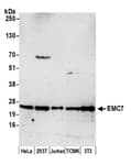 Detection of human and mouse EMC7 by western blot.