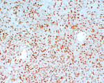Detection of human MGMT by immunohistochemistry.