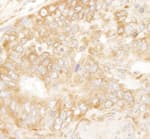 Detection of mouse RPL7 by immunohistochemistry.