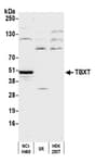 Detection of human TBXT by western blot.