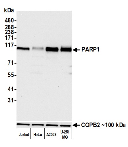 Rabbit anti-PARP1 Recombinant Monoclonal Antibody [BLR182J]