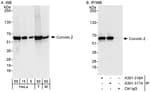 Detection of human and mouse Coronin 2 by western blot (h&amp;m) and immunoprecipitation (h).
