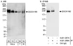 Detection of human and mouse DOCK180 by western blot (h&amp;m) and immunoprecipitation (h).