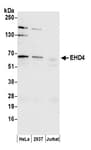 Detection of human EHD4 by western blot.
