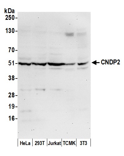 Detection of human and mouse CNDP2 by western blot.