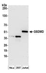 Detection of human GSDMD by western blot.