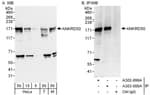 Detection of human and mouse ANKRD50 by western blot (h&amp;m) and immunoprecipitation (h).