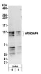 Detection of human ARHGAP4 by western blot.