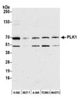 Detection of human and mouse PLK1 by western blot.