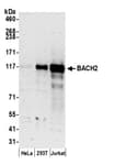 Detection of human BACH2 by western blot.