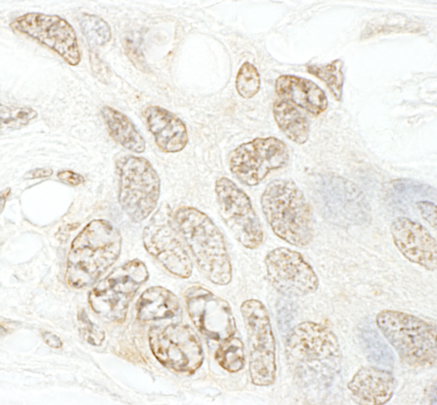 Rabbit anti-hSET1B IHC Antibody