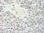 Detection of mouse HMG2a by immunohistochemistry.