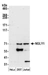 Detection of human NGLY1 by western blot.