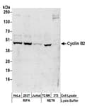 Detection of human and mouse Cyclin B2 by western blot.