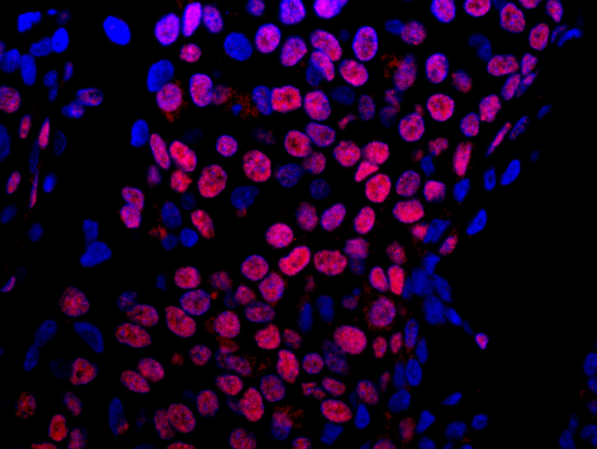 Rabbit anti-E1B-AP5 IHC Antibody