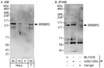 Detection of human SREBP2 by western blot and immunoprecipitation.