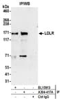 Detection of human LDLR by western blot of immunoprecipitates.