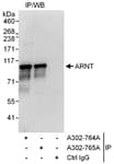 Detection of human ARNT by western blot of immunoprecipitates.